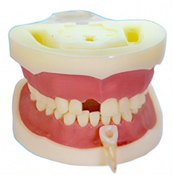 HG-E14 Root Canal Model